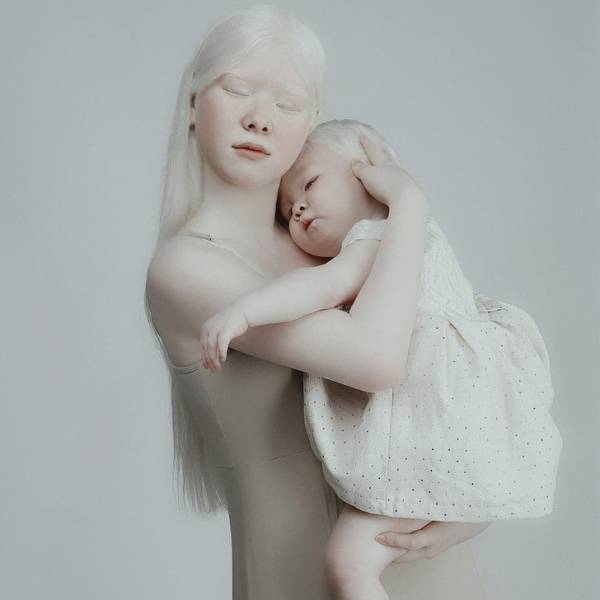 Albino Sisters Go Viral With Their Unusual Photos