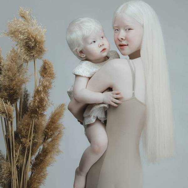 Albino Sisters Go Viral With Their Unusual Photos