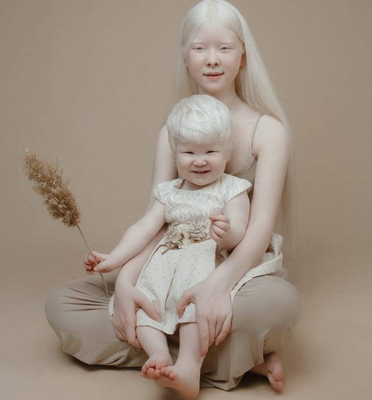 Albino Sisters Go Viral With Their Unusual Photos