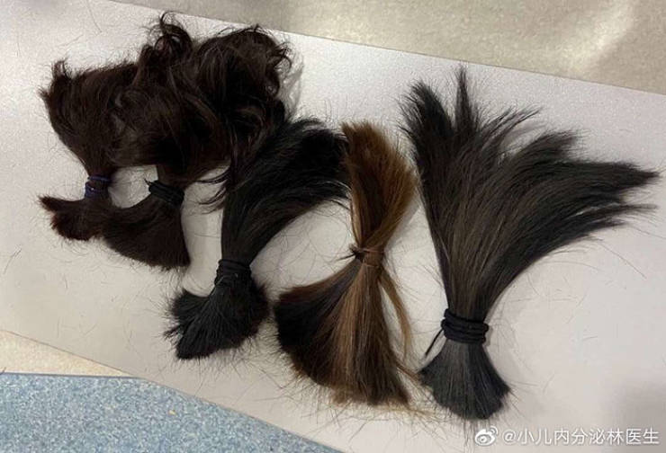 What Chinese Medical Personnel Is Going Through Working With Coronavirus