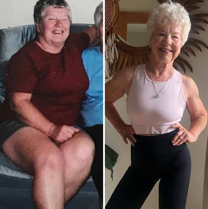 73-Year-Old Granny Loses Over 20 Kilos Inspired By Her Daughter, Gets Her Health Stabilized