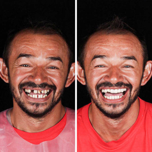 This Brazilian Dentist Travels To Offer His Services To Poor People For Free
