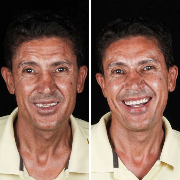 This Brazilian Dentist Travels To Offer His Services To Poor People For Free