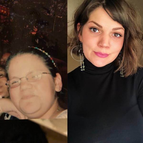 “Before And After” Photos Of People Show All The Difference