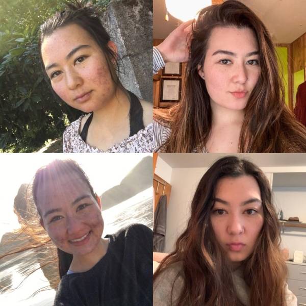 “Before And After” Photos Of People Show All The Difference