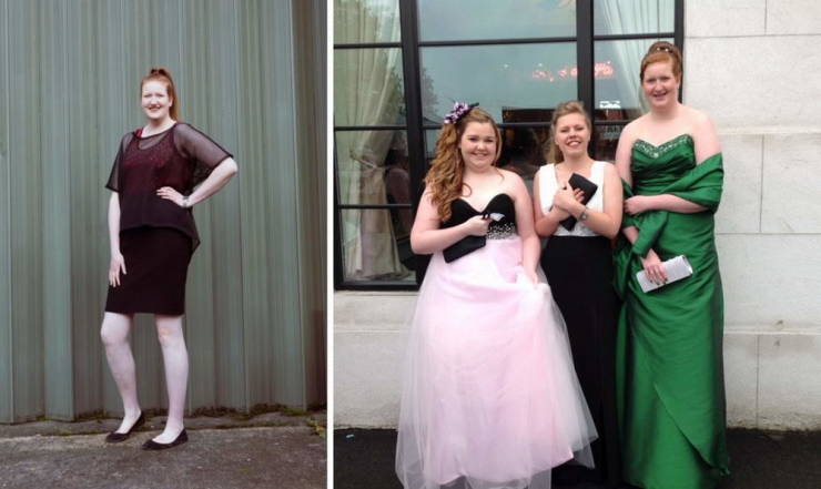 2-Meter-High Waitress Who Was Bullied In School Becomes A Model