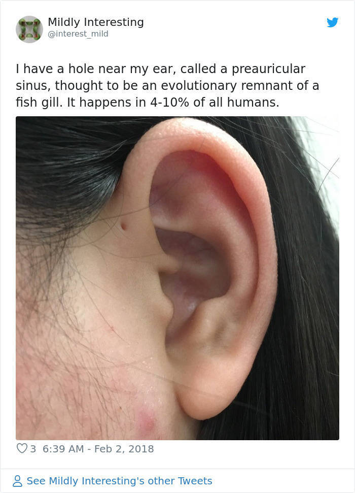 But What If That Tiny Hole Above Your Ear Serves A Purpose?