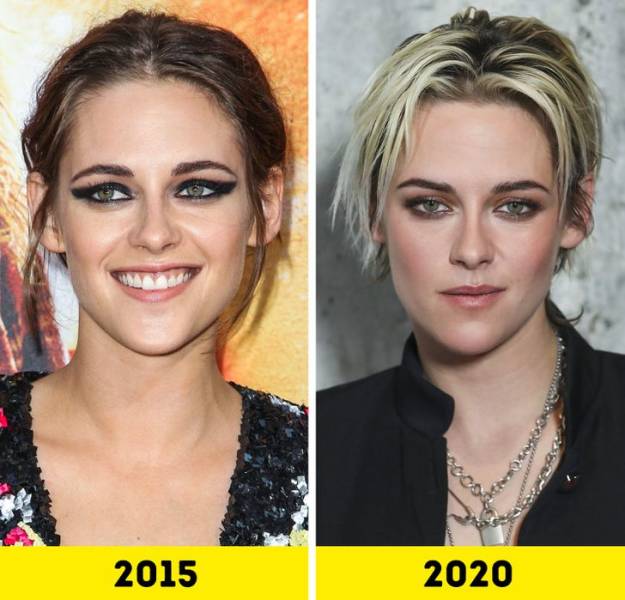 Celebs Who’ve Gone Through A Lot Of Changes Over The Last Five Years