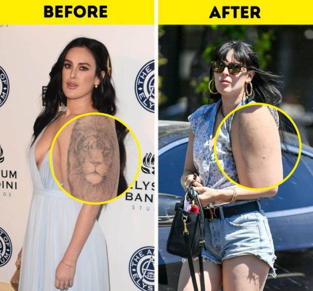 Celebs Who Got Rid Of Their Tattoos