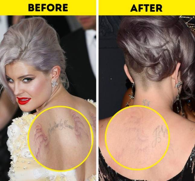 Celebs Who Got Rid Of Their Tattoos