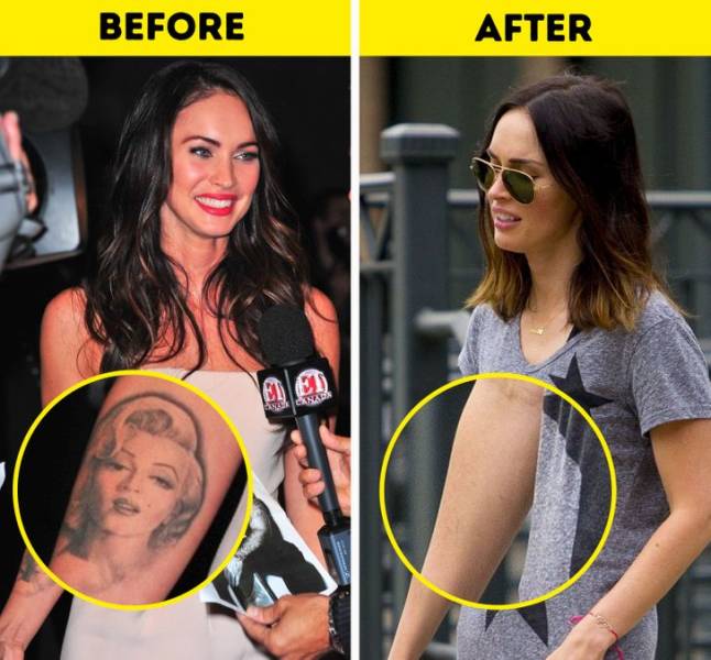 Celebs Who Got Rid Of Their Tattoos