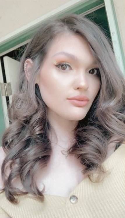 Woman Loses 88 Kilos And Changes Her Life Woman Loses 88 Kilos And Changes Her Life