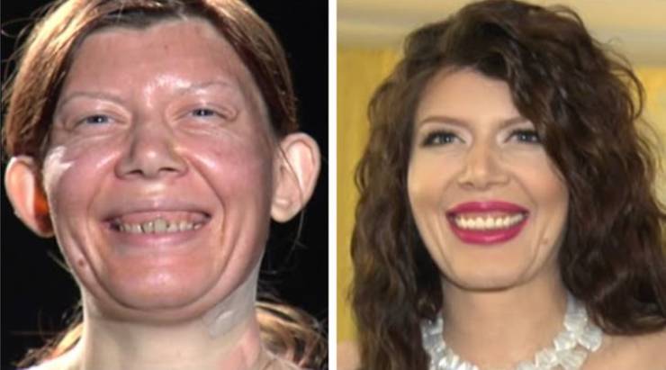 Women Who Changed Thanks To Transformation Shows