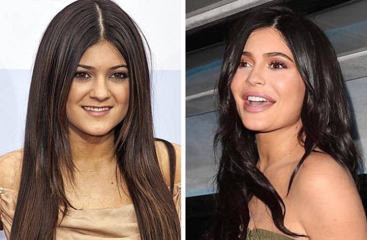 How Celebrity Smiles Changed With Their Rise To Fame