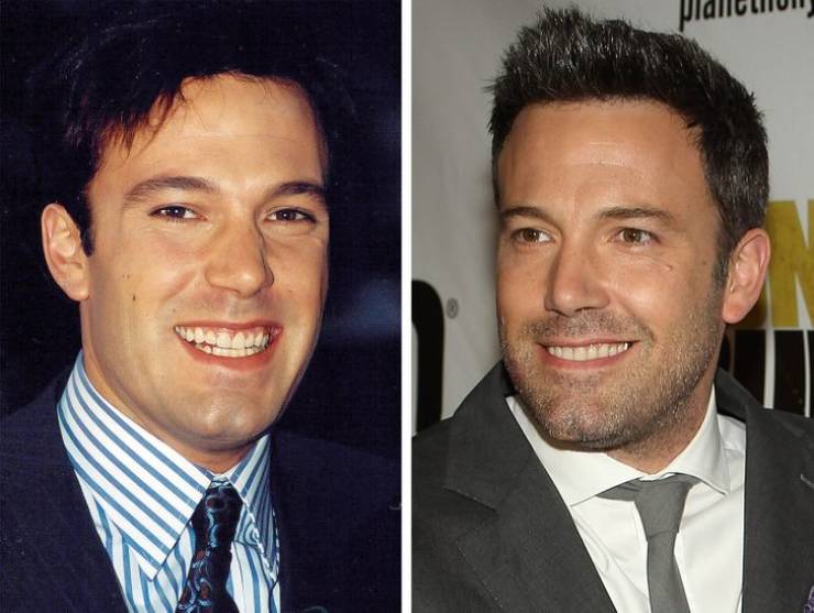 How Celebrity Smiles Changed With Their Rise To Fame