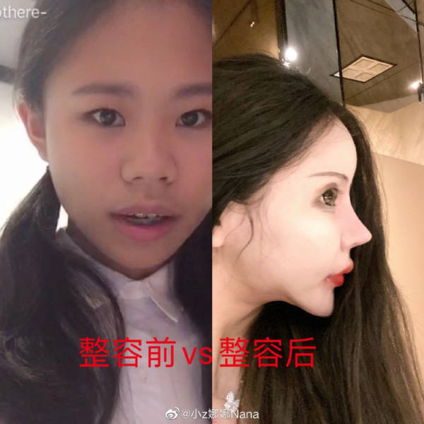 Chinese Schoolgirl Endured Almost A Hundred Plastic Surgeries To Become A Doll