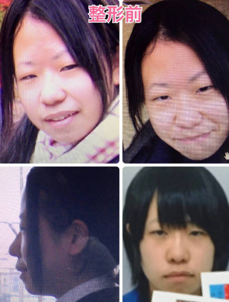 Japanese Girl Transforms With The Help Of Plastic Surgery