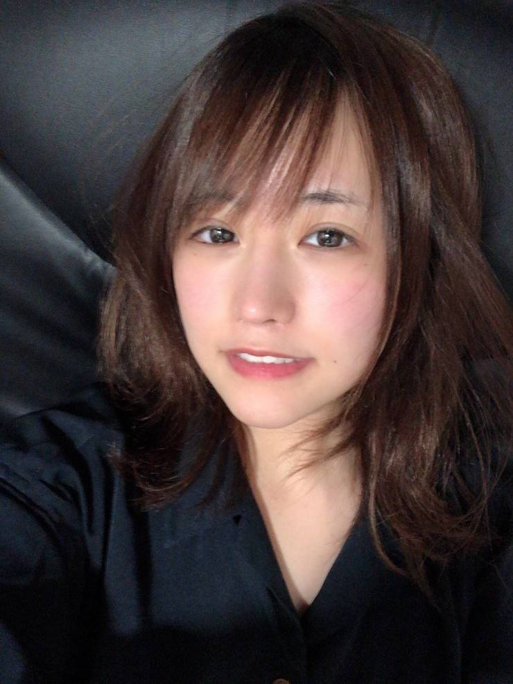 Japanese Girl Transforms With The Help Of Plastic Surgery