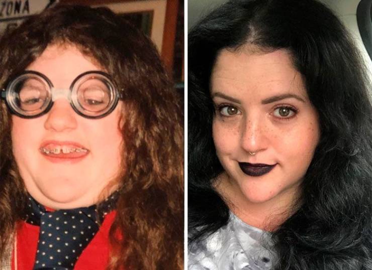 “Ugly Ducklings” Share Their Drastic Transformations