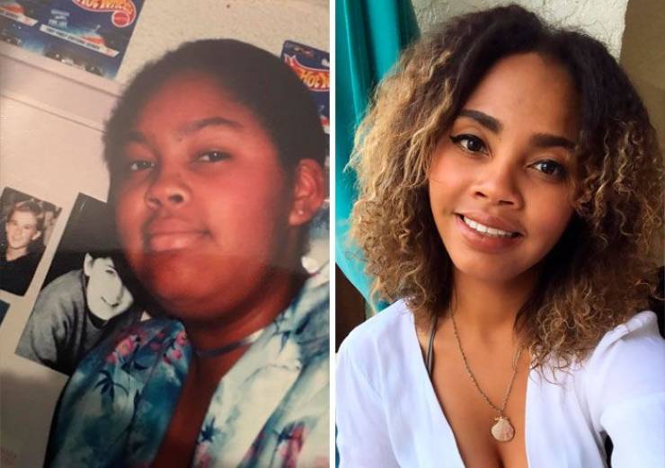 “Ugly Ducklings” Share Their Drastic Transformations
