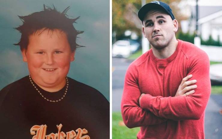 “Ugly Ducklings” Share Their Drastic Transformations