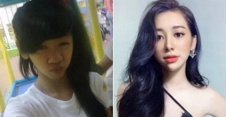 Vietnamese Girl Undergoes Radical Plastic Surgery After A Breakup With Her Boyfriend