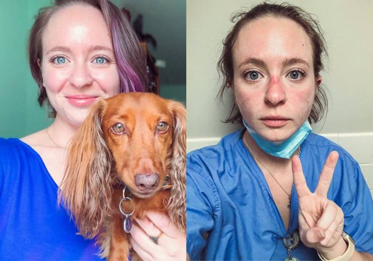 Nurse Shows Her Photos Of Before And After Nine Months Of Pandemic