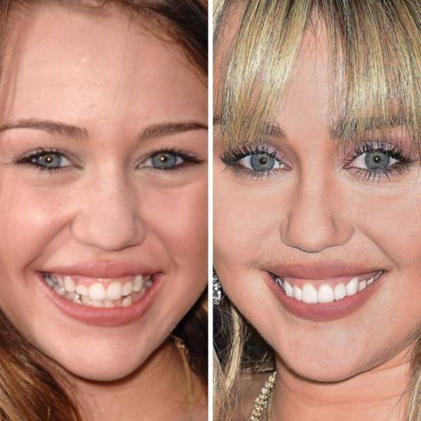 Celebrities Change Too…