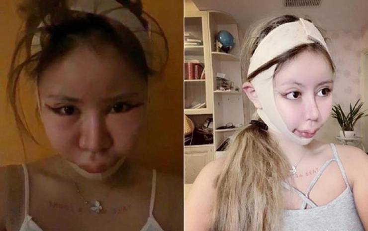 This 16-Year-Old Schoolgirl Went Through A Hundred Plastic Surgeries Over The Course Of Three Years…