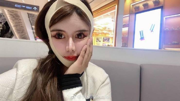 This 16 Year Old Schoolgirl Went Through A Hundred Plastic Surgeries Over The Course Of Three