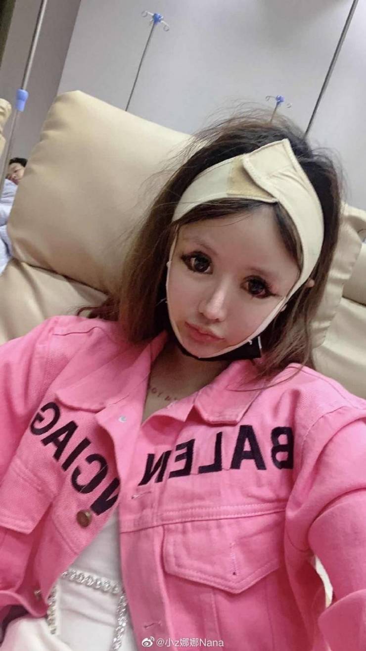 This 16-Year-Old Schoolgirl Went Through A Hundred Plastic Surgeries Over The Course Of Three Years…