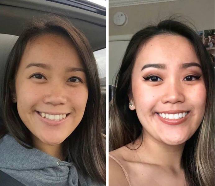 People Who Decided To Try Their Luck With Plastic Surgery