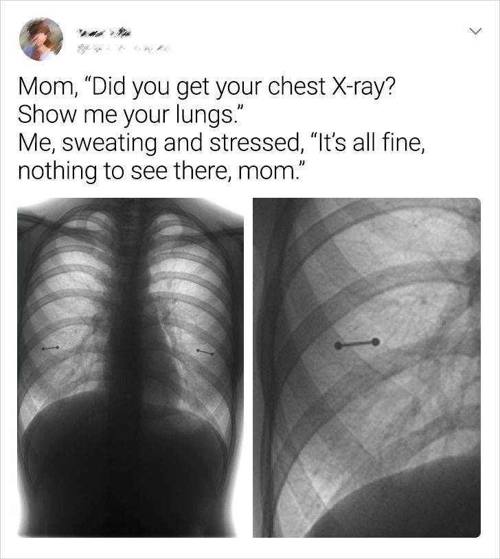 You Can’t Hide Anything From X-Rays!