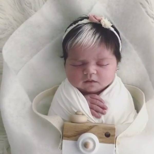 Mother Teaches Her Two-Year-Old Daughter To Be Proud Of The White Streak She Has In Her Hair