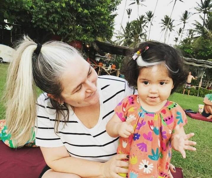 Mother Teaches Her Two-Year-Old Daughter To Be Proud Of The White Streak She Has In Her Hair
