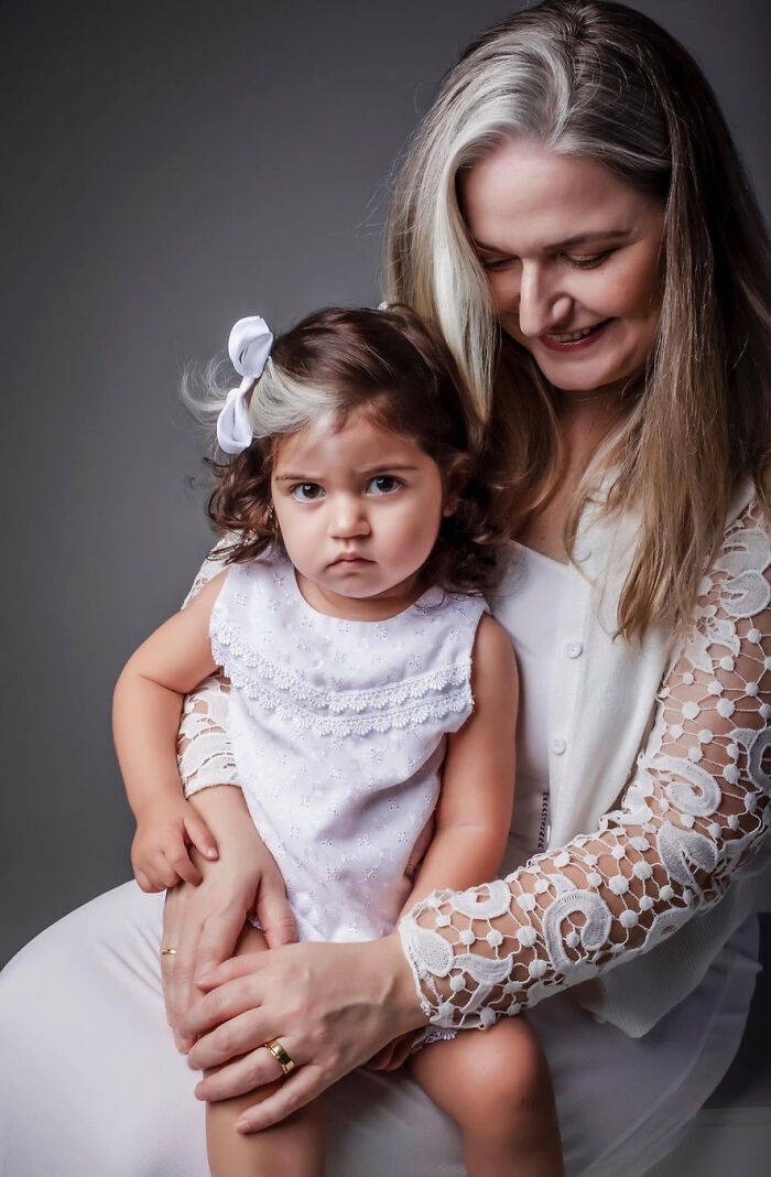 Mother Teaches Her Two-Year-Old Daughter To Be Proud Of The White Streak She Has In Her Hair