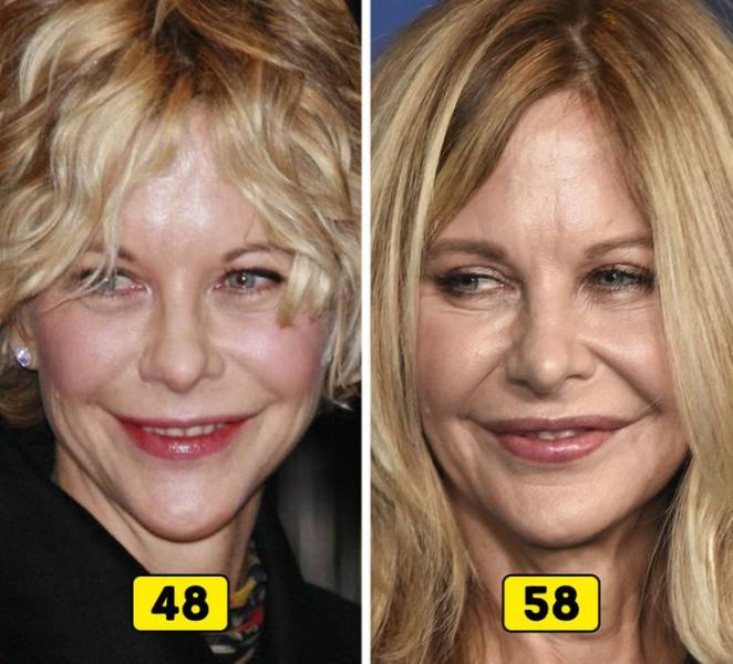 How Celebrities Changed In The Past 10 Years