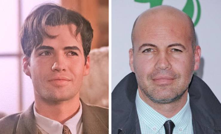 Celebrities Who Lost Their Hair But Not Their Charm