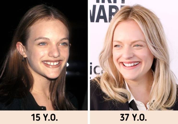 Celebrities With Unusual Looks: In Their Youth Vs These Days