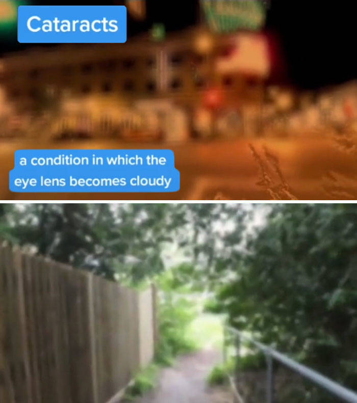 Medical Student Explains How People With Different Medical Conditions See The World Around