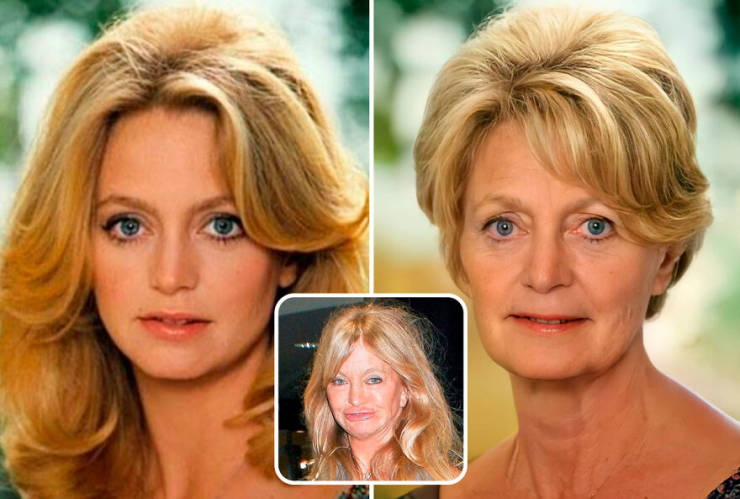 Celebrities Without Their Plastic Surgeries…