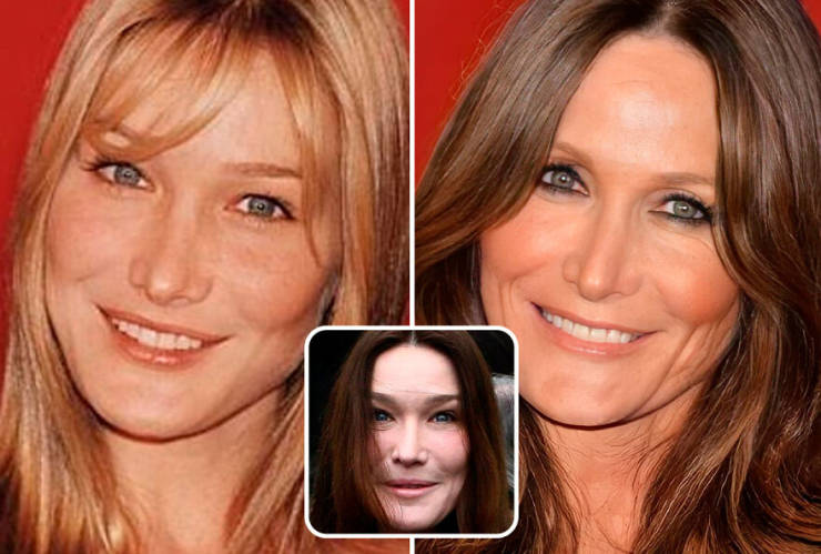 Celebrities Without Their Plastic Surgeries…