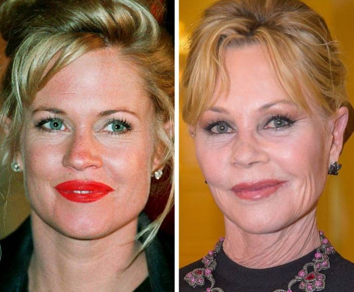 Celebrity Close-Ups Showing How They’ve Changed