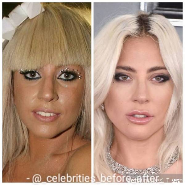 Celebrities: Before And After