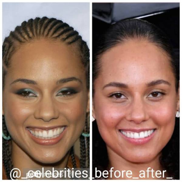Celebrities: Before And After