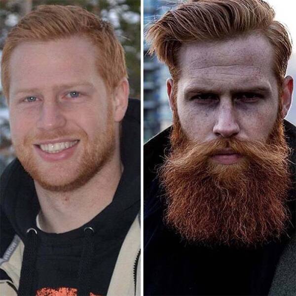 Beardless Vs With Beard