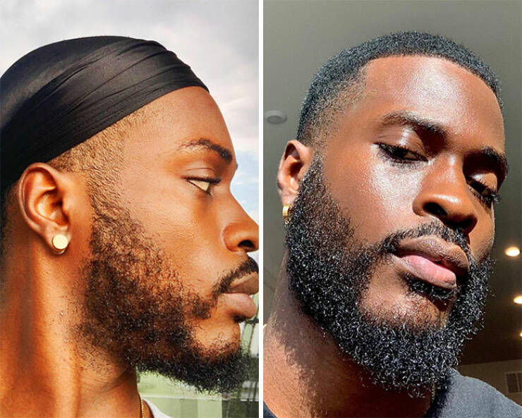 Beardless Vs With Beard