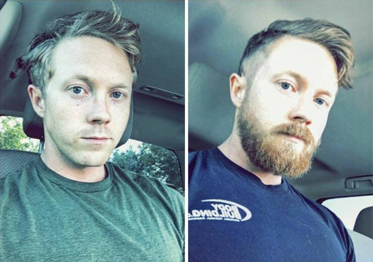 Beardless Vs With Beard