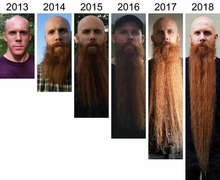 Beardless Vs With Beard