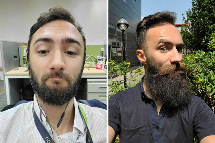 Beardless Vs With Beard